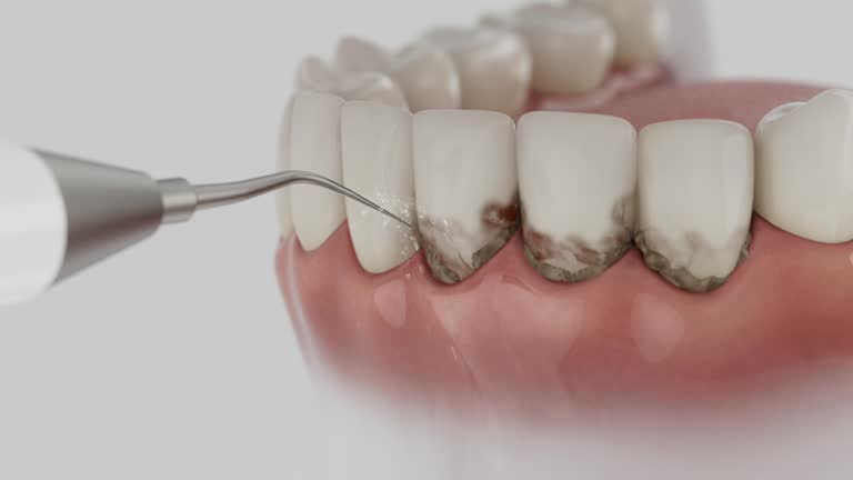 Reliable Dental Implants contractor in Harrison, MI by Smile Center Dentistry